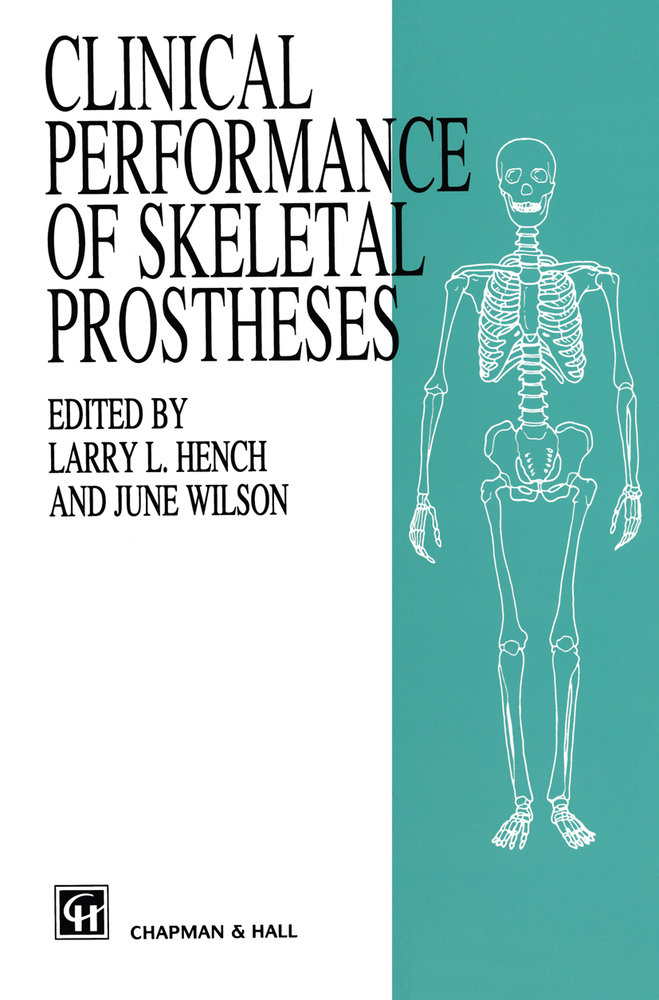 Clinical Performance of Skeletal Prostheses